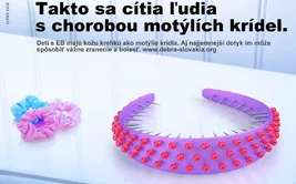 Choroba motýlích krídiel, keď aj jemný dotyk vie zraniť