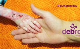 Givingtuesday - Svetový deň darovania