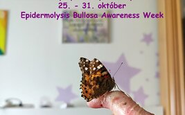 Medzinárodný týždeň Epidermolysis bullosa 2022